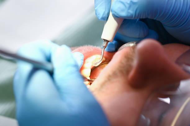 Best Emergency Tooth Extraction  in Huntersville, NC