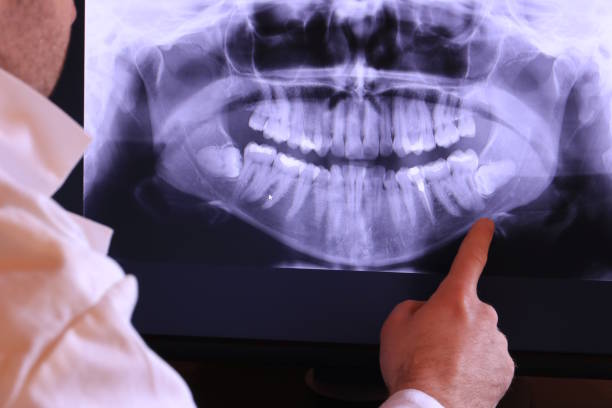 Best Urgent Tooth Repair  in Huntersville, NC
