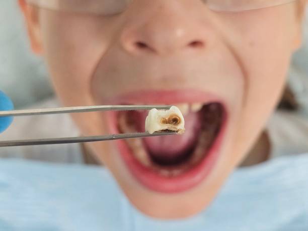 Best Emergency Gum Pain Relief  in Huntersville, NC