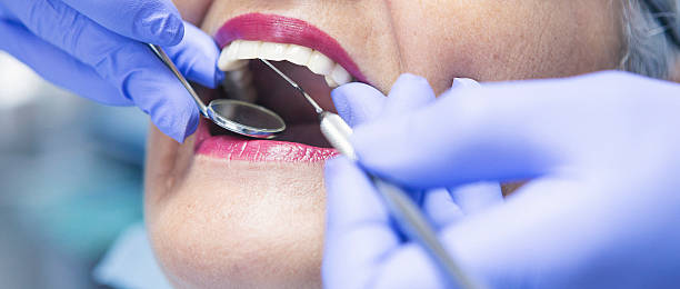 Best Chipped Tooth Repair Near Me  in Huntersville, NC